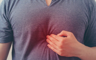 10 Natural and Effective Ways to Relieve Heartburn